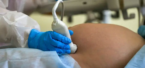 Ectopic Pregnancy