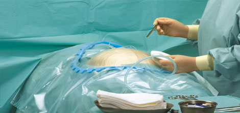 All Major & Minor Gynae Operations