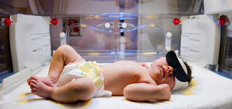 Jaundice Treatment