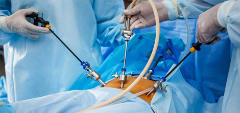 All Gynae Laparoscopic Surgeries