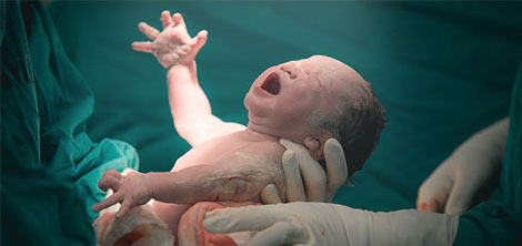 Normal Delivery