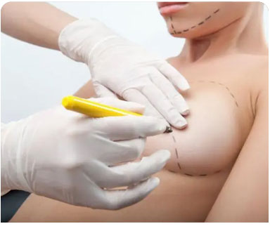 Breast Surgery