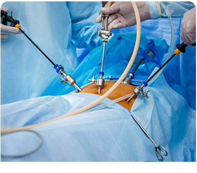Gynae Surgeries