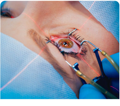 Laser Surgery