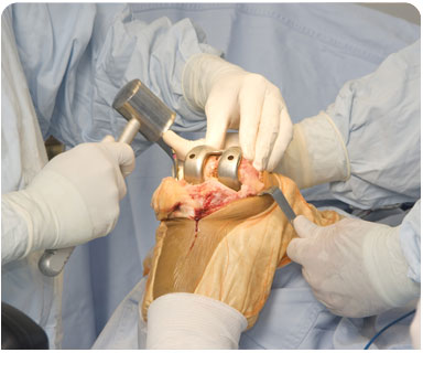 Orthopedic Surgery