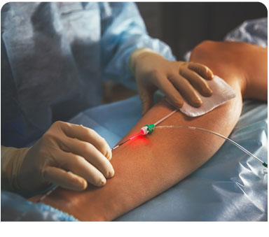 Varicose Veins Surgery